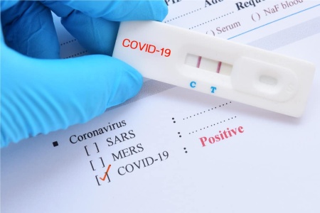 Buy Fake Covid-19 Test Results